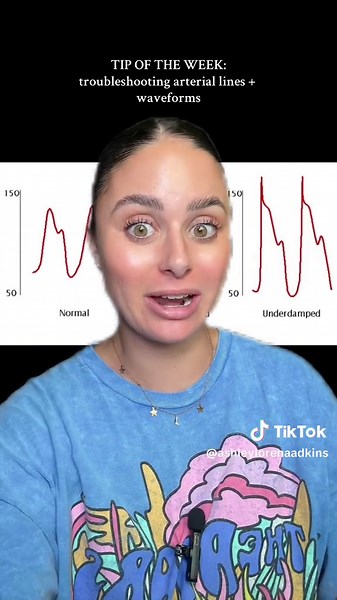 Replying to @umm.hannahh arterial line waveforms plus troubleshooting tips!!! #icunurse #ArterialLines #NursingSchool #NursingStudent #Anesthesia #CriticalCareNursing #NursesOfTikTok #CRNA