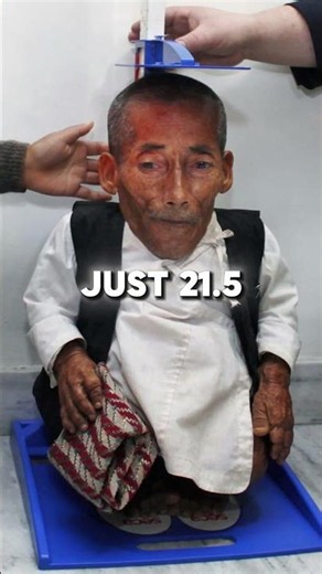 The shortest man ever