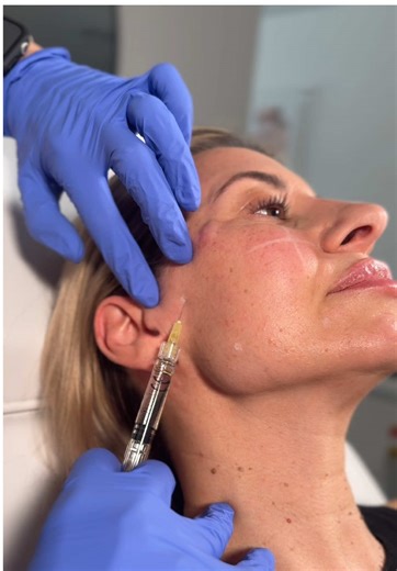 𝐖𝐡𝐲 𝐞𝐯𝐞𝐫𝐲𝐨𝐧𝐞’𝐬 𝐜𝐡𝐨𝐨𝐬𝐢𝐧𝐠 𝐬𝐤𝐢𝐧 𝐛𝐨𝐨𝐬𝐭𝐞𝐫𝐬 💧 Think of it as hydration on another level. Skin boosters work beneath the surface to deeply nourish, improve elasticity and smooth texture — leaving skin healthier, fresher and naturally radiant. It’s the treatment clients return to again and again, because results aren’t just seen — they’re felt. 𝐒𝐭𝐫𝐨𝐧𝐠𝐞𝐫 𝐬𝐤𝐢𝐧. 𝐋𝐚𝐬𝐭𝐢𝐧𝐠 𝐠𝐥𝐨𝐰. 𝐂𝐨𝐧𝐟𝐢𝐝𝐞𝐧𝐜𝐞 𝐢𝐧 𝐞𝐯𝐞𝐫𝐲 𝐥𝐢𝐠𝐡𝐭. 𝗣𝗟𝗘𝗔𝗦𝗘 book your appo