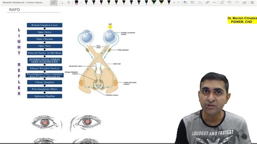 Manish Chhabra on Instagram: "#RAPD #EyeOPD #ophthalmology #neetpg2025 #fmge2025 #inicet #fmge_mci_exam #eyecoach #manishchhabra"