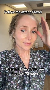 1.2K views | Sharing updates for 72 hours after my Fraxel treatment,...