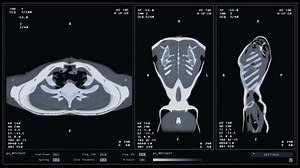 Diagnostic scanner examining the patients skeleton at the modern clinic. Diagnostic scanner inspecting the skeleton to identify organ damages. Diagnostic scanner analysing the human skeleton.