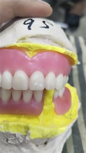 Teeth Arrangement Of Soft Lining Denture 😁😁😁#softdenture #shortvideo