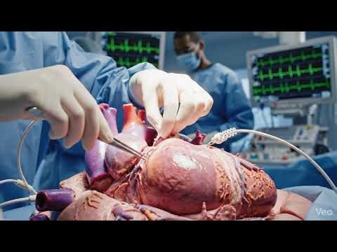 How a pacemaker set in heart