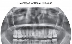 Dental Radiology Digital Imaging Made Easy, 2nd Edition