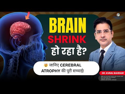 Brain Shrink हो रहा है? 🤯 जानिए Cerebral Atrophy की पूरी सच्चाई! | Cerebral Atrophy | Dr. Kunal