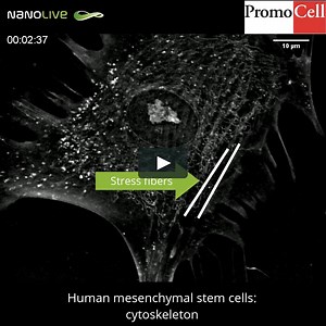 Label-free live cell imaging of Human Mesenchymal Stem Cells in vivo: The Cytoskeleton