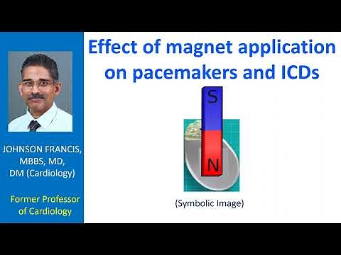 Effect of magnet application on pacemakers and ICDs