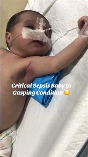 Critical Sepsis Baby In Gasping Condition | Urgent NICU Care