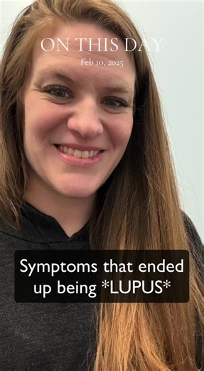 Recognizing Early Symptoms of Lupus