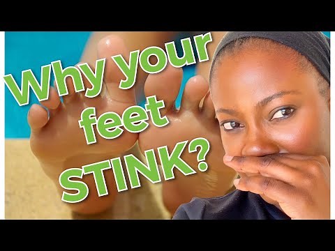 Why you have stinky feet?