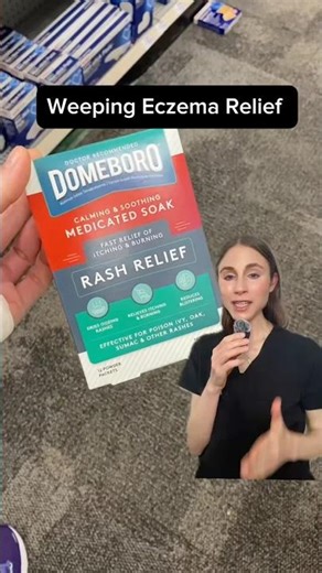 Weeping Eczema Hack (Derm Approved)