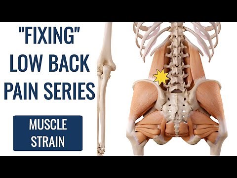 How to Fix Lower Back Strain (DON'T STRETCH)