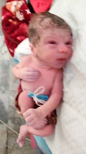 1.1M views · 10K reactions | Beautiful Newborn Baby Amazing Birthday Moments of First Cry #adorablebabies #babies #firstcry #newborns #beautifulbabies #cutebabies | After Birth | Facebook