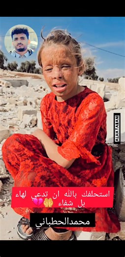 أفضل صورة في العالم تاريخ #التصوير 💛💛💛💛💛💛💛💛💛💛💛💛💛 بدأ باكتشاف مبدأين حاسمين: الأول هو إسقاط صورة الكاميرا المظلمة والثاني هو اكتشاف أن بعض المواد قد تغيرت بشكل واضح بسبب التعرض للضوء [2] . لا توجد قطع أثرية أو أو أوصاف تشير إلى أي محاولة لالتقاط صور بمواد حساسة للضوء قبل القرن الثامن عشر. المشهد من النافذة في لو غراس 1826 أو 1827 ، يعتقد أنها أقدم صورة للكاميرا الناجية. [1] تحسين إعادة توجيه أصلي (يسار) وملون (يمين). حوالي عام 1717، استخدم يوهان هينريش سكولزي طينا حساسا للضوء لالتقاط