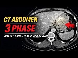 CT Scan Triple Phase Abdomen, CECT Triple Phase, CECT Abdomen 3 Phase With Bolus Tracking
