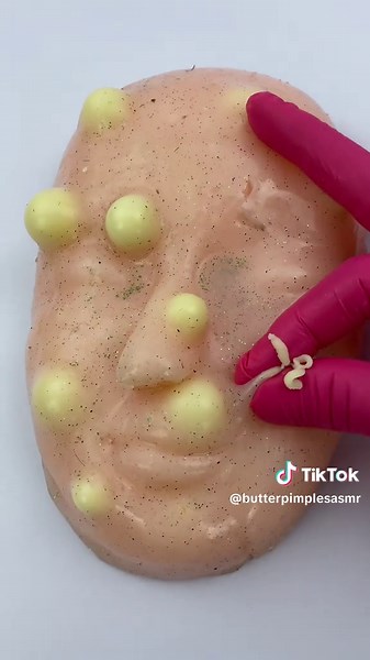 Part 2: remove pimples on face . Satisfying relaxing asmr #artificialskin #siliconemodel #education #oddlysatisfying #pimplepopping #relaxingcontent #skincaretips