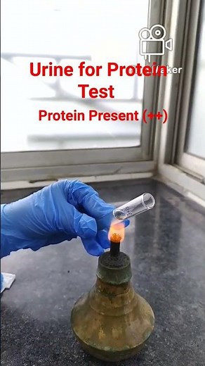Urine for Protein Test