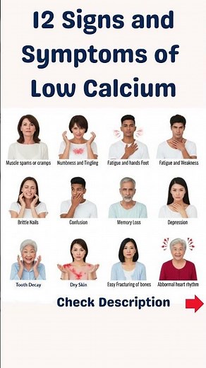 Symptoms of Low Calcium 12 Signs You Need to Know