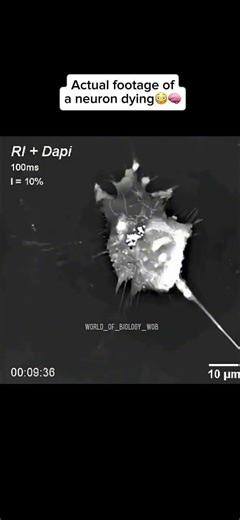 A Neuron dying under a microscope 😳🧠