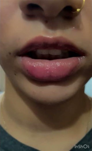 Dead cockroach asmr#asmr #asmrfood #cockroach