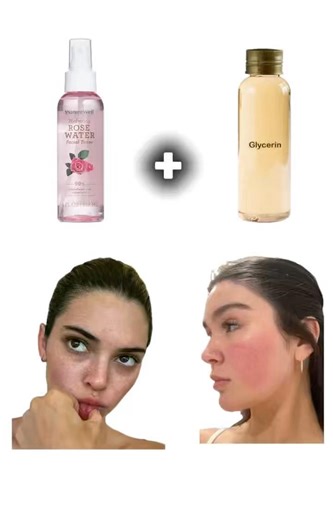 Rose Water + Glycerin = "Instant Face Glow" #shorts #beauty #faceglow #skincare