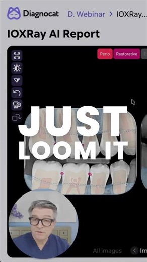 Just Loom It. 🎥