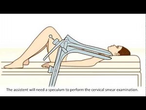 A cervical screening test - What can you expect?