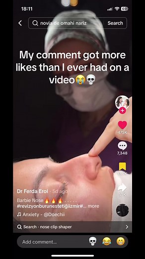 More like pls #blowup #true #amazing #fyp