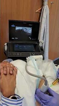 RECTUS FEMORIS INJECTION WITH PLASMA -PRP