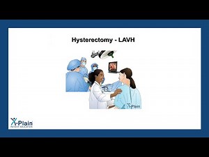 Hysterectomy - LAVH