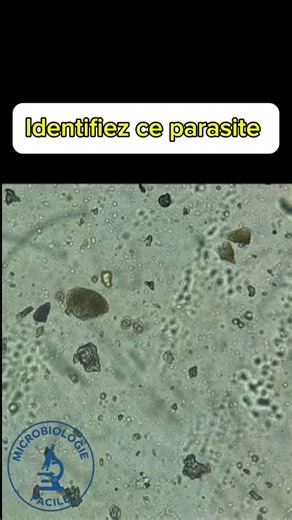 Identifiez ce parasite au microscope #laboratory #parasitologia #science #fyp