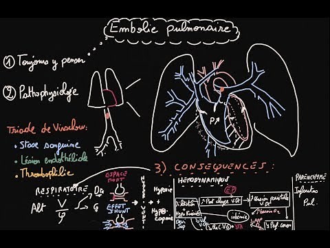 Embolie pulmonaire - Patho-physiologie - Partie 1 - Docteur Synapse
