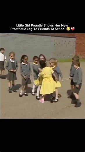Little Girl Proudly Shows Her New Prosthetic Leg To Friends At School 🥹❤️