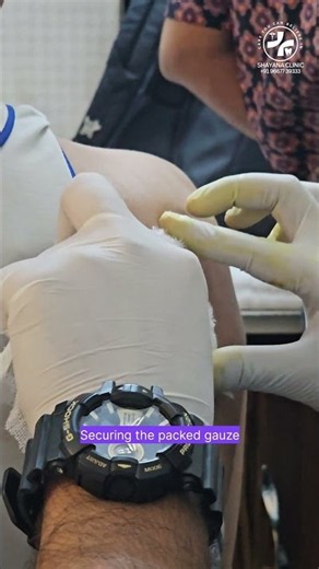 Abscess Drainage | Dr. Shadab Ahmed Siddiqui #shayanaclinic