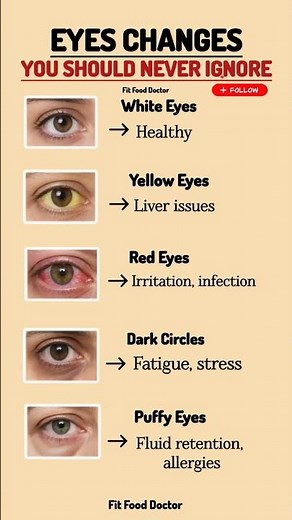 Eye Changes You Should Never Ignore | What Your Eyes Say About Your Health #healthylifestyle