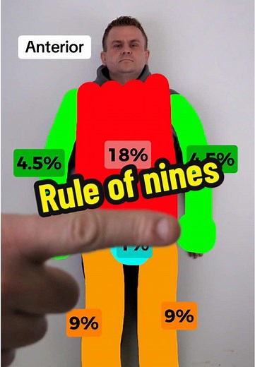Understanding the Rule of Nines for Burn Assessment