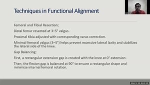 Robotic Joint Replacement: Advancements in 2024 - As It Stands Today