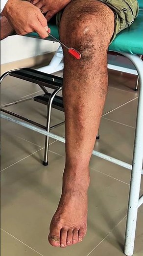 ☑️ What is the function of reflex tests and how should they be interpreted? Leave your answer in ...