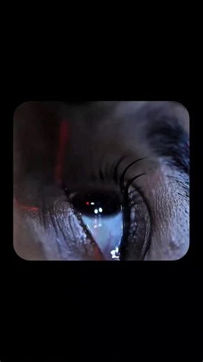 EraScope on Instagram: "LASIK (Laser-Assisted In Situ Keratomileusis) is a quick, painless eye surgery that reshapes the cornea so light focuses correctly on the retina. In a normal eye, light bends unevenly, causing blurry vision that requires glasses or contact lenses. LASIK uses a precise laser to gently change the cornea’s shape, allowing your eyes to focus naturally — so you can see clearly without specs. The procedure takes about 10–15 minutes for both eyes. First, numbing drops are applie