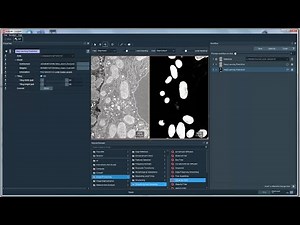 Segmentation of FIBSEM Mitochondria using deep learning in Amira or Avizo Software