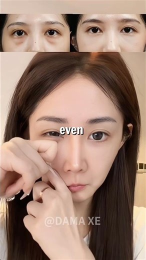 😵‍💫Fix Your Under-Eye Routine Before It Ages You💁‍♀️