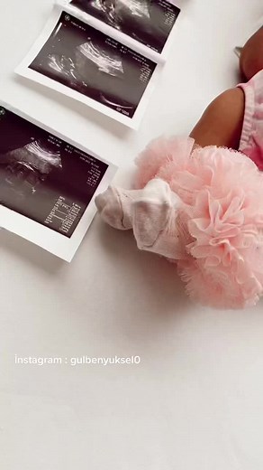 Üzümlü kekim 40 günlük oldu bugün bunu paylaşmayı unutmuşum teyzoşları 🌸 Maşallah demeyi unutmayın lütfen 🙏 insta gelsenize kızlar ✨#eflinverda #tiktokanneleri