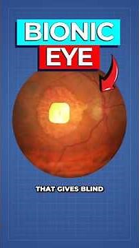 Scientists Create REAL Bionic Eye