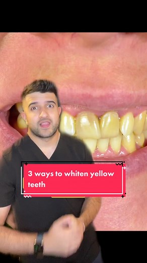 3 Ways to Whiten Yellow Teeth