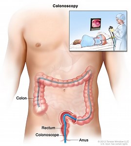 How far into the body does a colonoscopy go? [2025] | QAQooking.wiki