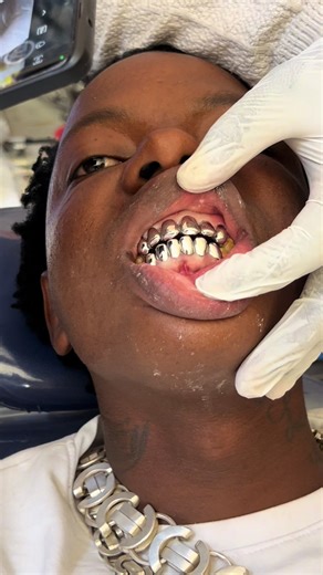 Permanent Silver Tooth and Canine Services