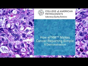 How to Simplify Cancer Pathology Reporting With eFRM
