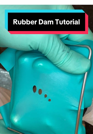 Rubber Dam Tutorial. 📹Full step by step videos on YouTube. Link in bio👆🏼 #rubberdam #dentist #dentistry #dentalstudent #dental