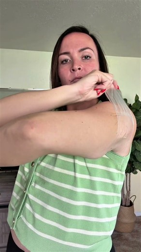 👀 Loose arm skin and how to deal with it